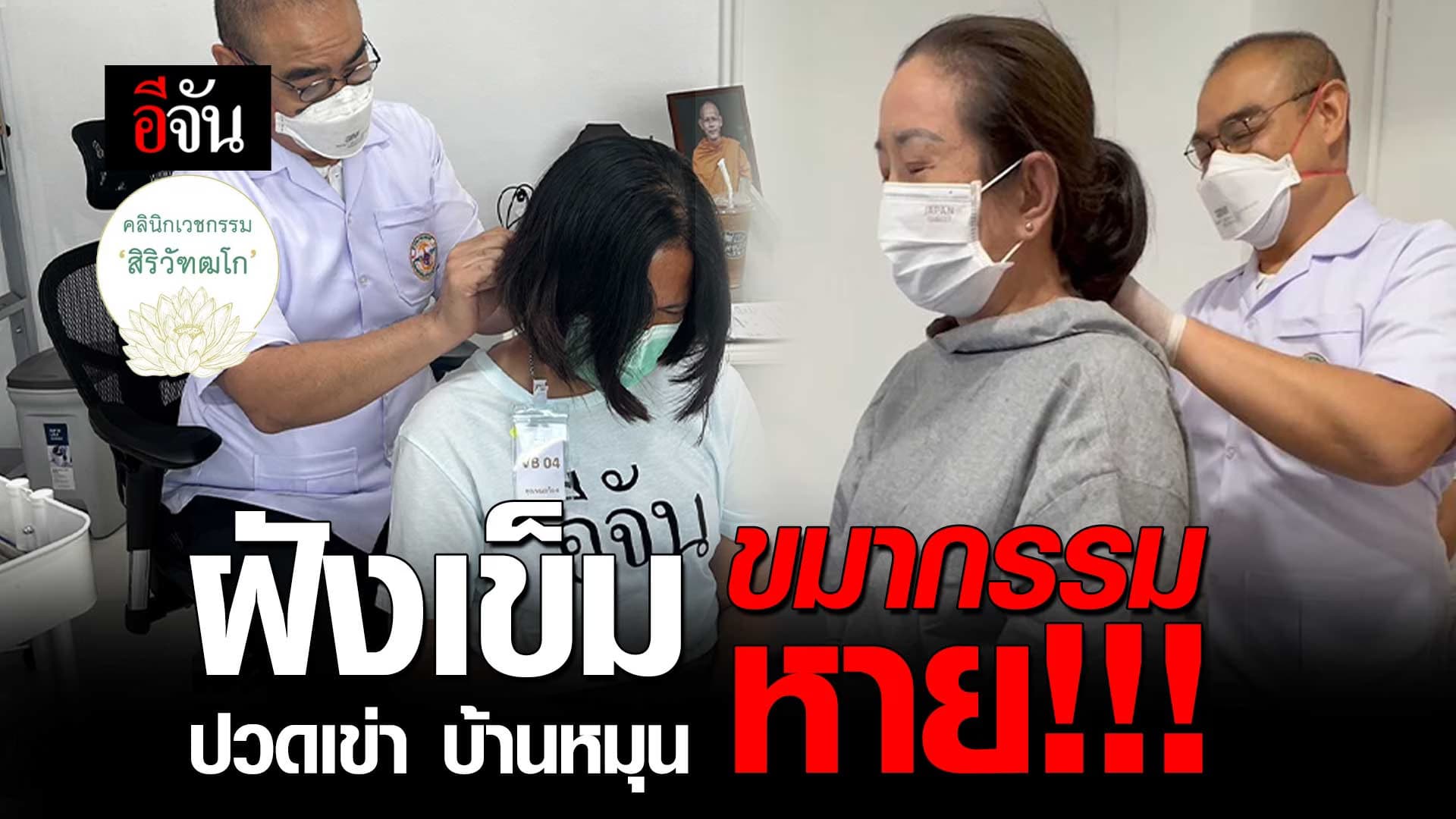 🎬 ฝังเข็ม ขมากรรม อาการ ปวดเข่า บ้านหมุน หาย!!!