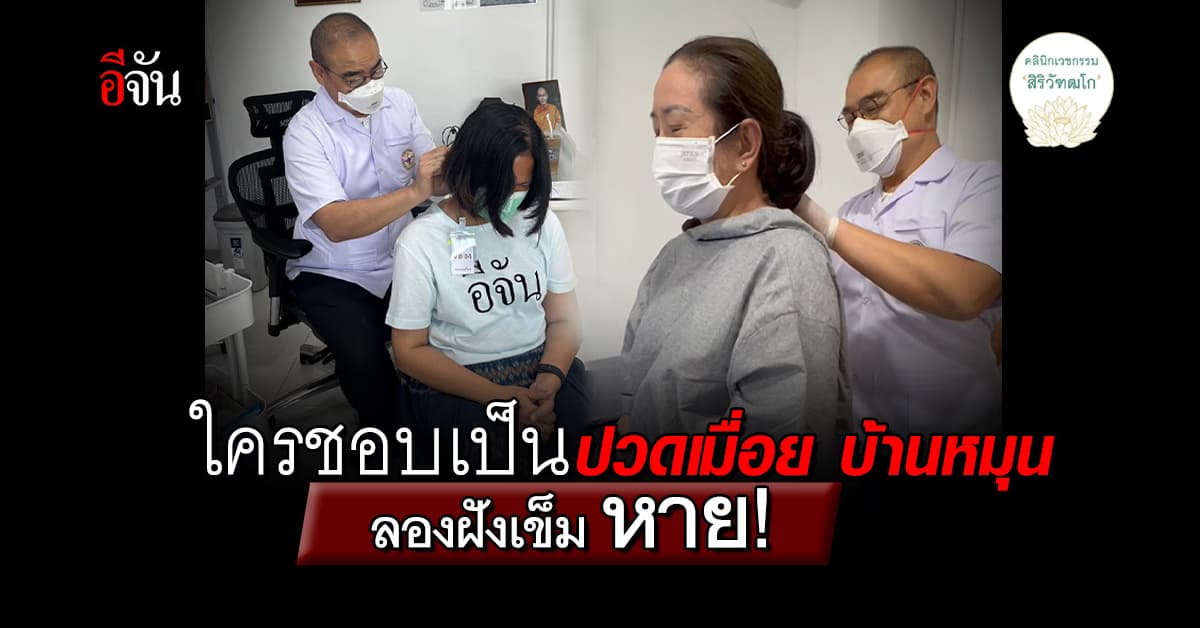 ฝังเข็มฟรี ขมากรรมเจ้ากรรมนายเวร อาการปวด หาย!