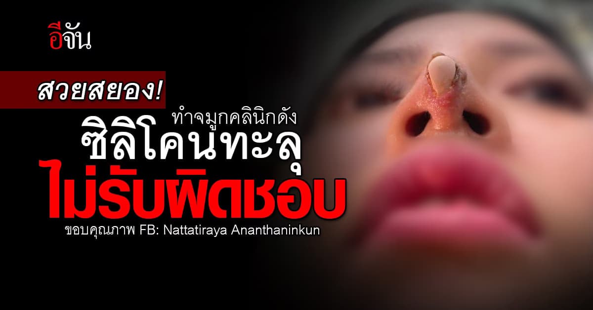 สวยสยอง! ทำจมูกคลินิกดัง ซิลิโคนทะลุ ไม่รับผิดชอบ แถมเซลโทรด่า-ขู่ฟ้อง