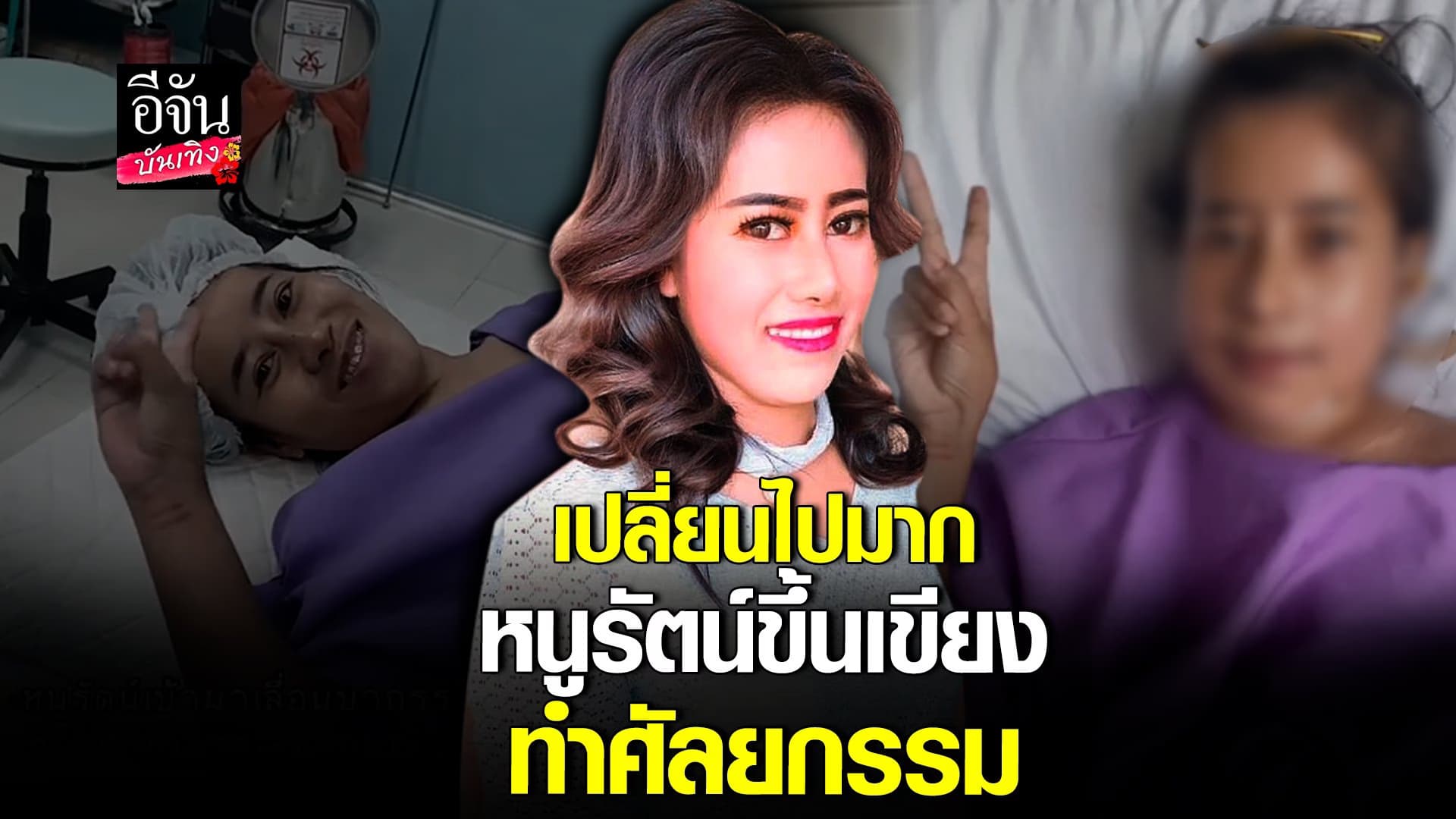 🎬 คลิปบันเทิง :หนูรัตน์ เปลี่ยนไป แทบจำไม่ได้ หลังขึ้นเขียงทำศัลยกรรม