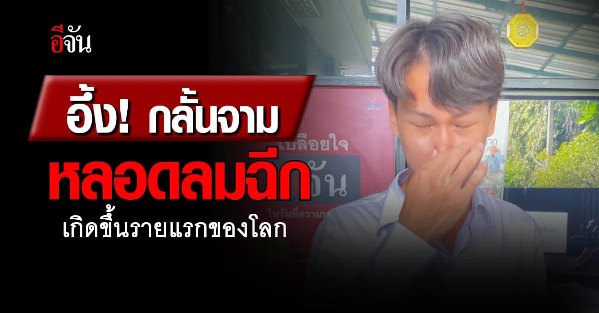 อึ้ง! กลั้นจามจนหลอดลมฉีก เกิดขึ้นรายแรกของโลก