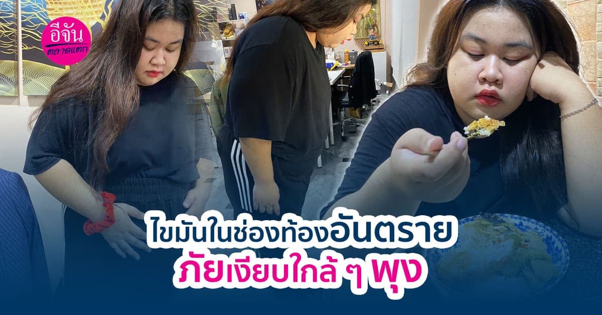 อ้วน ลงพุง อันเกิดจากไขมันในช่องท้อง เสี่ยงเป็นโรคร้ายได้