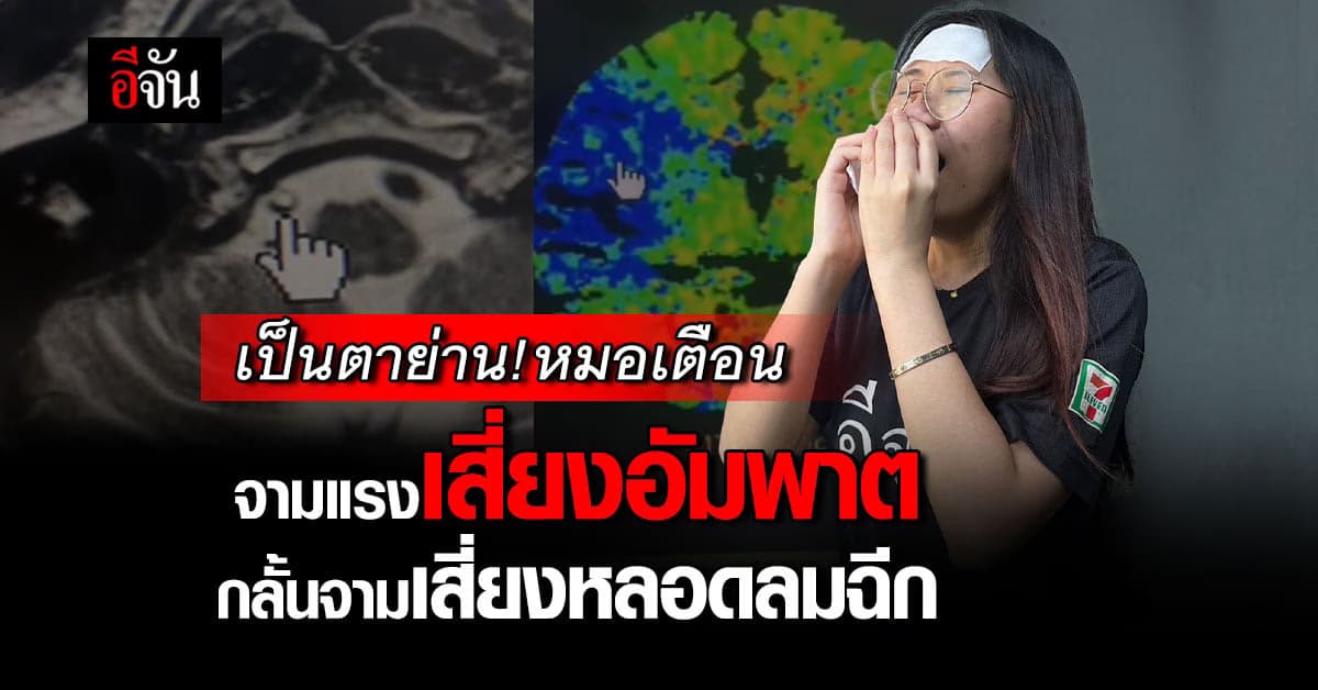 เป็นตาย่าน! หมอเตือน จามแรงเสี่ยงอัมพาต กลั้นจามเสี่ยงหลอดลมฉีก