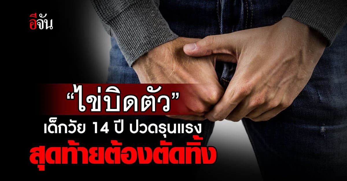 เด็กชายวัย 14 ปี ปวดไข่รุนแรง พบอัณฑะบิดตัว แพทย์ต้องตัดทิ้ง