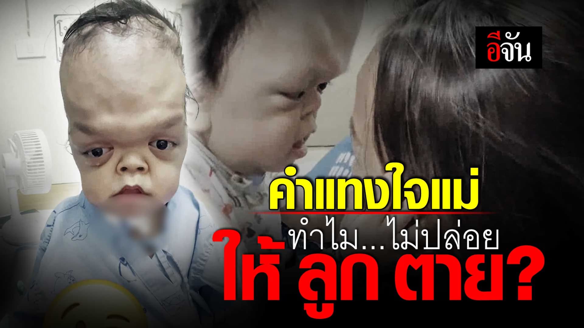 🎬 หัวอกคนเป็นแม่ ลูกเกิดมาพิการ ยื้อชีวิตลูกให้รอด กลับมาเจอคำพูดทำร้ายจิตใจ