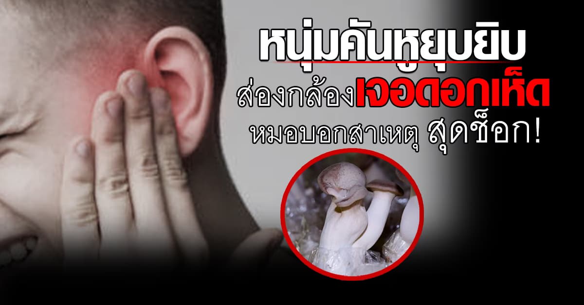 รู้สาเหตุ ช็อก! หนุ่มคันหูยุบยิบ ส่องกล้องเจอดอกเห็ด เพราะทำแบบนี้?