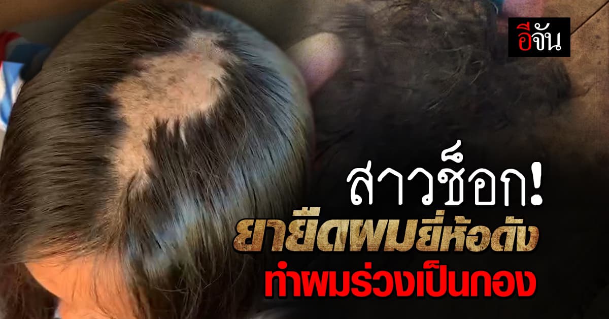 สาวเตือน! หลังหลงเชื่อรีวิว ใช้น้ำยายืดผมยี่ห้อดัง แต่ผลลัพธ์คือ ผมร่วงเป็นกอง