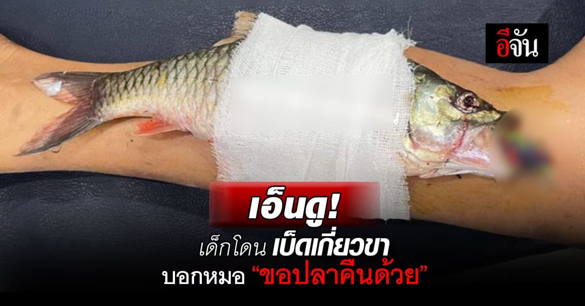 เอ็นดู! เด็กตกปลา โดนเบ็ดเกี่ยวขา ก่อนผ่าบอกหมอ “ขอปลาคืนด้วย”