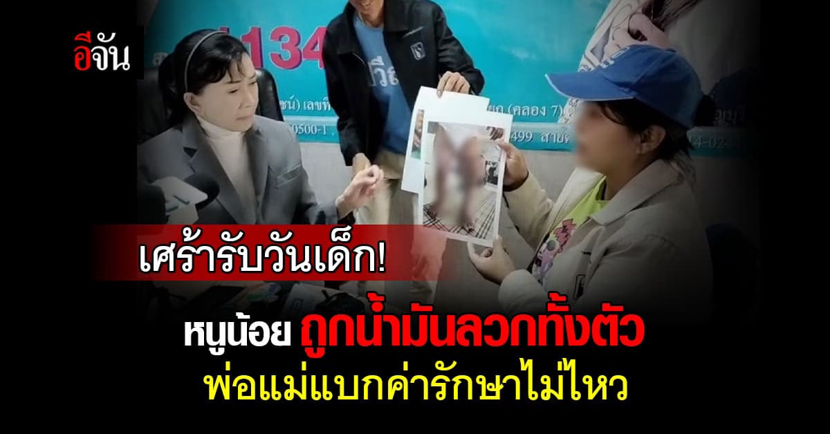 ลูก 2 ขวบ โดนน้ำมันลวกทั่วตัว พ่อแม่ วอนปวีณา ช่วยค่ารักษา เพราะบ้านยากจน