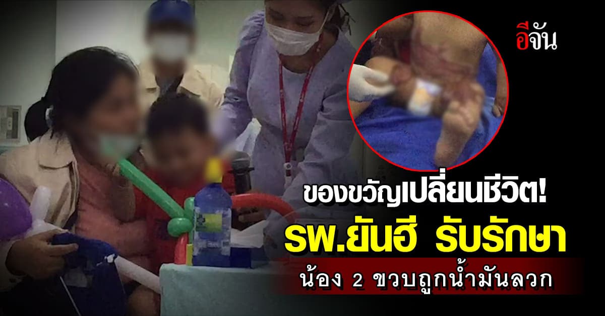 ใกล้ได้ชีวิตใหม่! รพ.ยันฮี ให้ของขวัญ หนูน้อย 2 ขวบ ถูกน้ำมันลวก ด้วยการรักษาแผล ที่สร้างความทรมานให้น้องมากว่า 8 เดือน