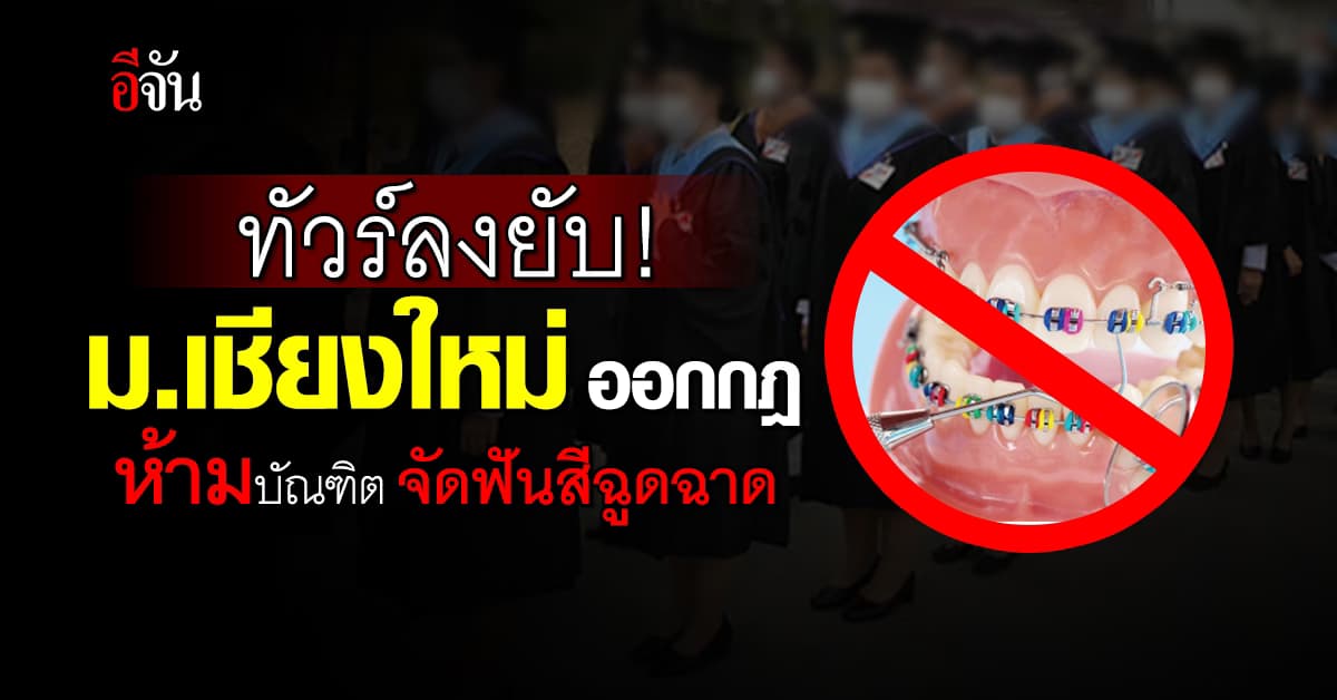 วิจารณ์ยับ! ม.เชียงใหม่ ออกกฎรับปริญญา ห้ามบัณฑิตจัดฟันสีฉูดฉาด