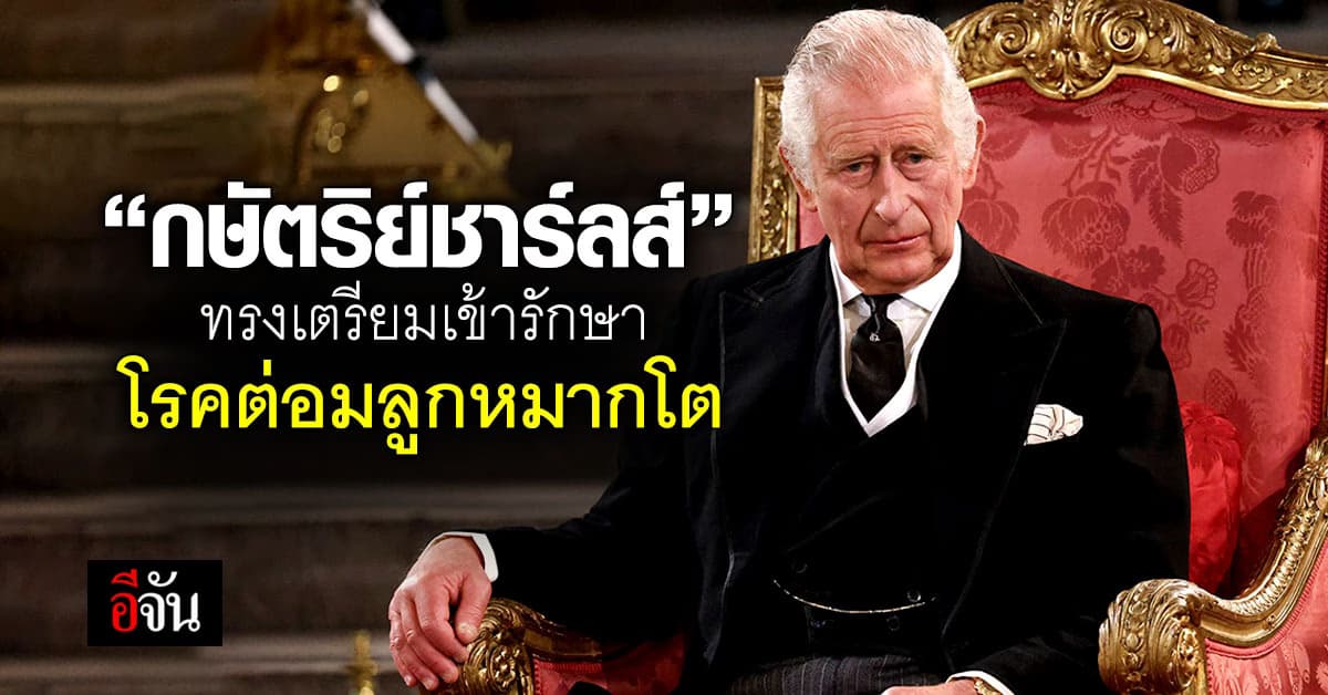 ‘กษัตริย์ชาร์ลส์’ ทรงเตรียมเข้ารักษา โรคต่อมลูกหมากโต