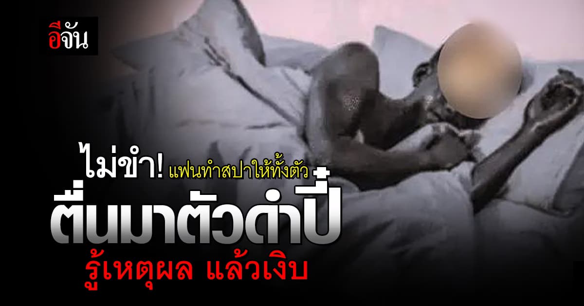 ไม่ขำ! แฟนทำสปาให้ทั้งตัว ตื่นมาตัวดำปี๋ รู้เหตุผลแล้วเงิบแรง บอกเลิกทันที