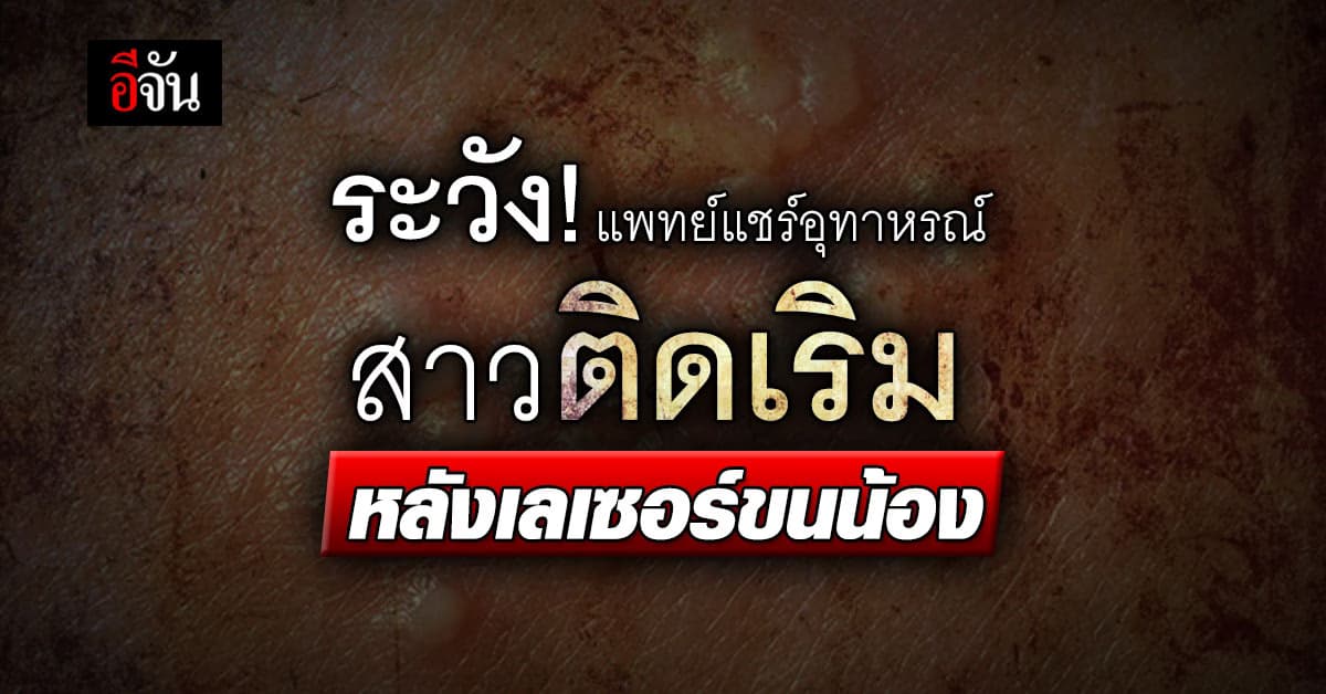 ช็อก! แพทย์แชร์อุทาหรณ์ สาวติดเชื้อเริม หลังเลเซอร์ขนน้อง