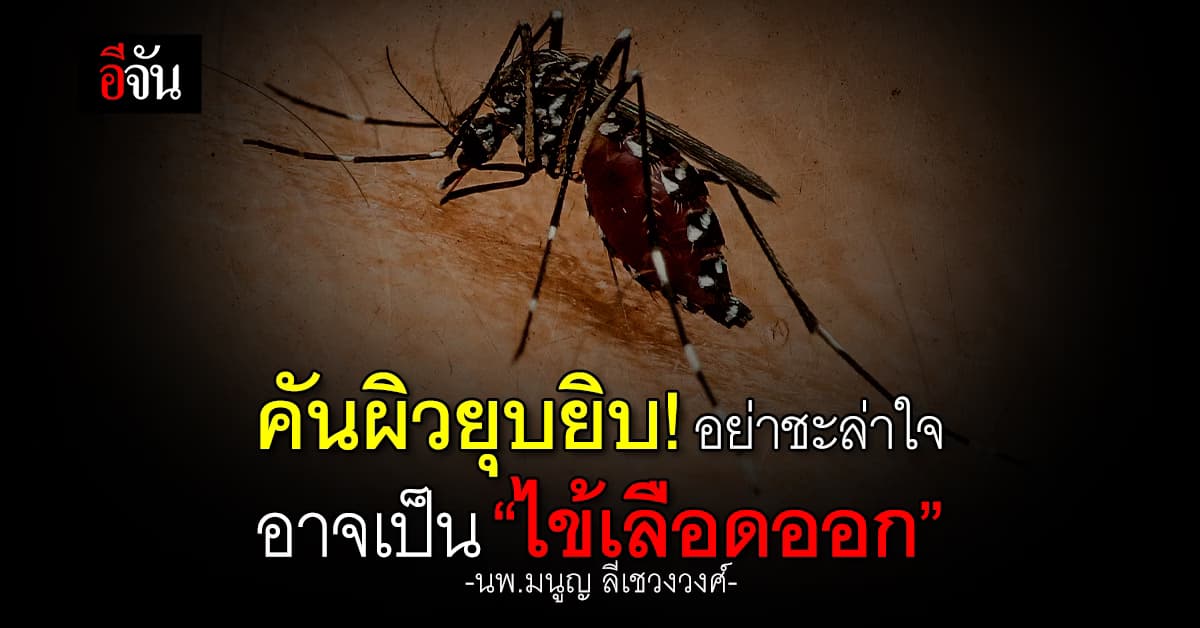 คันยุบยิบ! อย่าชะล่าใจ อาจเป็น “ไข้เลือดออก”