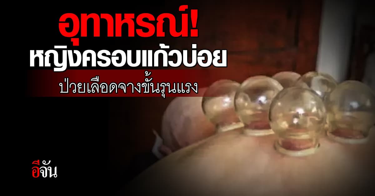 อุทาหรณ์! หญิงคลั่งครอบแก้ว จนเป็นโรคเลือดจางขั้นรุนแรง