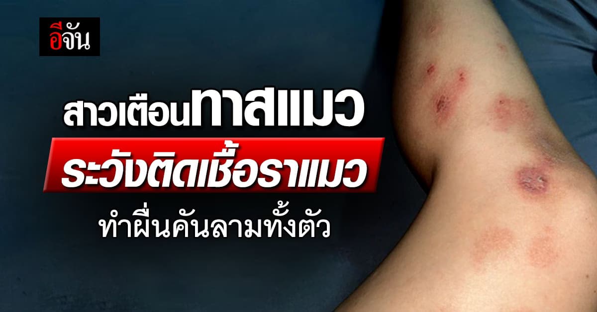 ทาสแมวระวัง! สาวโพสต์เตือนติดเชื้อราแมว ผื่นคันลามทั้งตัว  