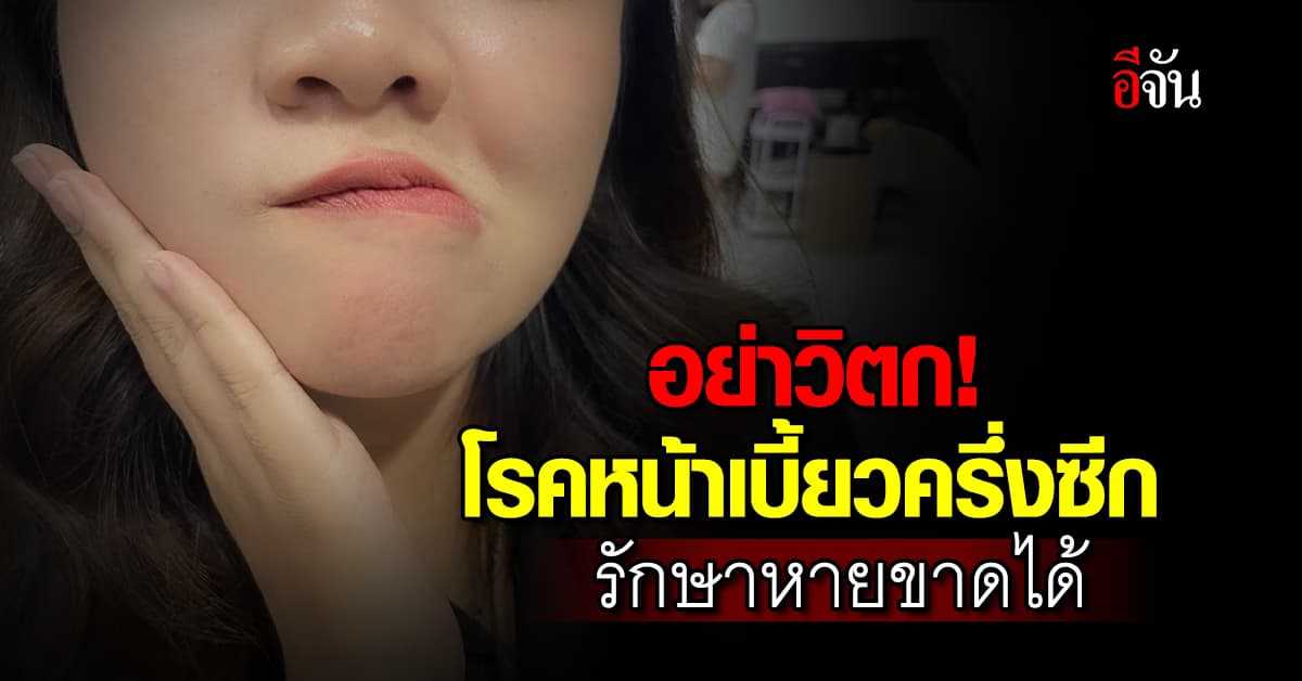 อย่าวิตก! แพทย์เผย โรคหน้าเบี้ยวครึ่งซีก รักษาหายขาดได้