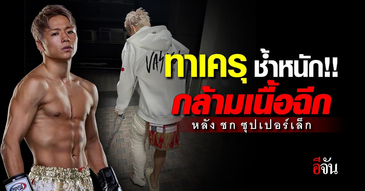 ช้ำหนัก ทาเครุ อัปเดตอาการ เดินไม่ได้ ซุปเปอร์เล็ก อวยพร หายไวๆ