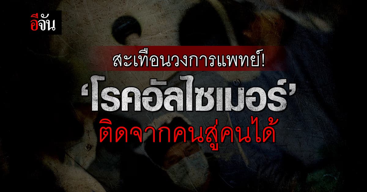 สะเทือนวงการแพทย์! เจอเคสหายาก ‘โรคอัลไซเมอร์’ ติดจากคนสู่คนได้