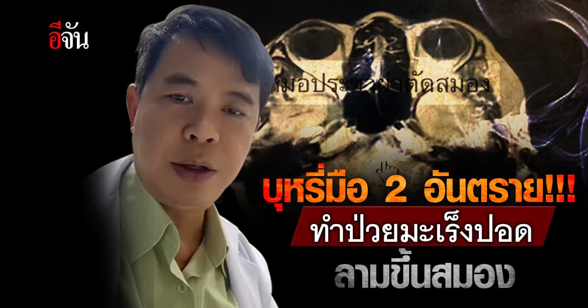 หมอยกเคสเตือน สาวป่วยมะเร็งปอด ลามขึ้นสมอง เพราะบุหรี่มือสอง