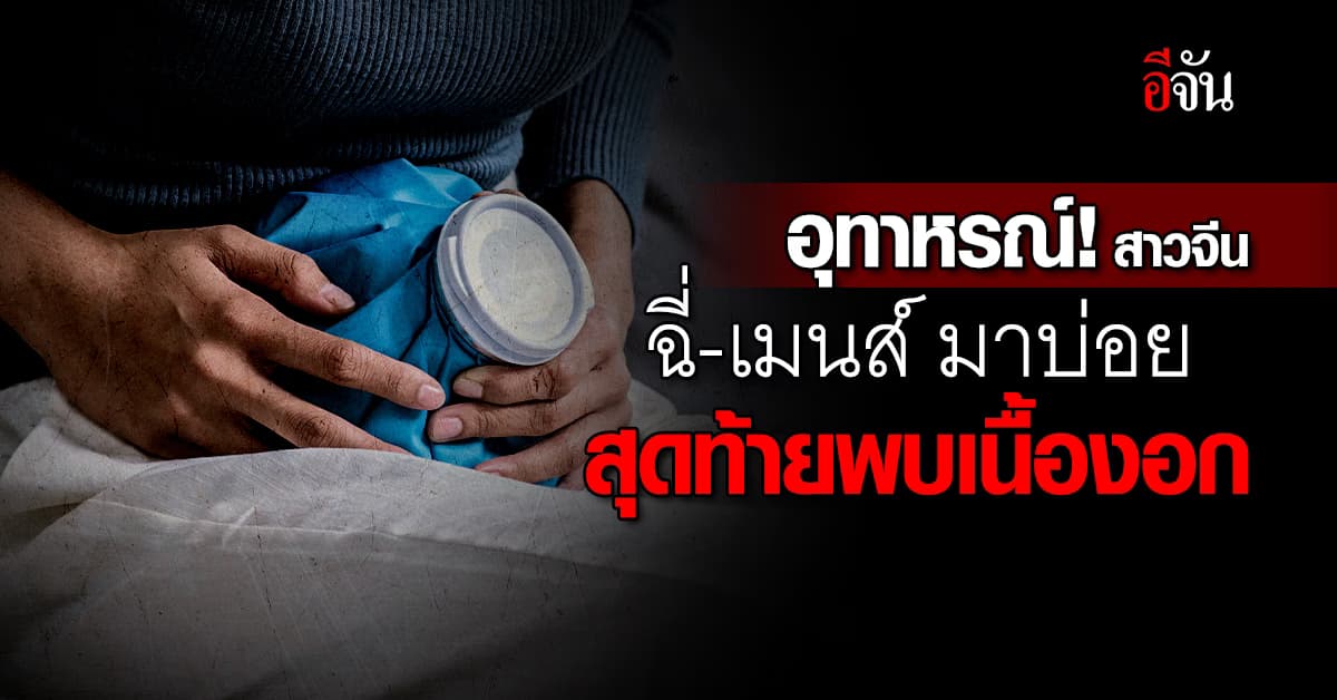 อุทาหรณ์! สาวจีนเป็นเมนส์บ่อย สุดท้ายพบเนื้องอกในต่อมใต้สมอง