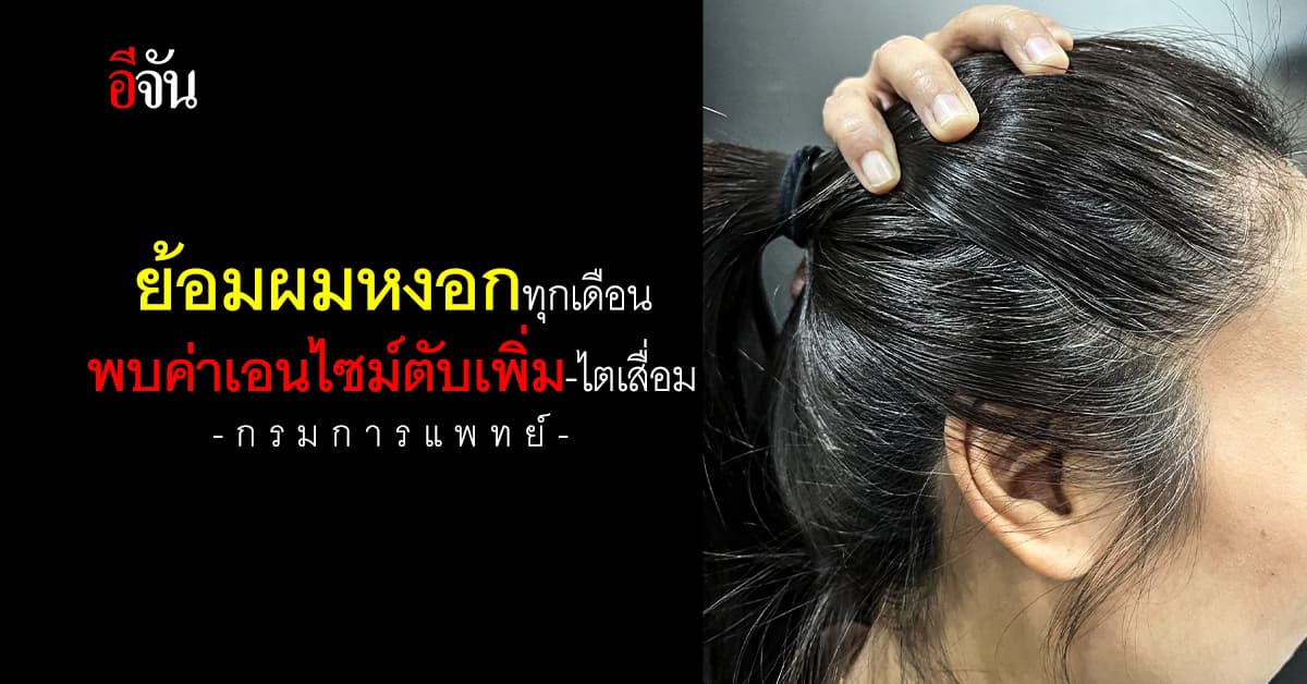 กรมการแพทย์ เผยย้อมผมหงอกทุกเดือน พบค่าเอนไซม์ตับเพิ่ม-ไตเสื่อม