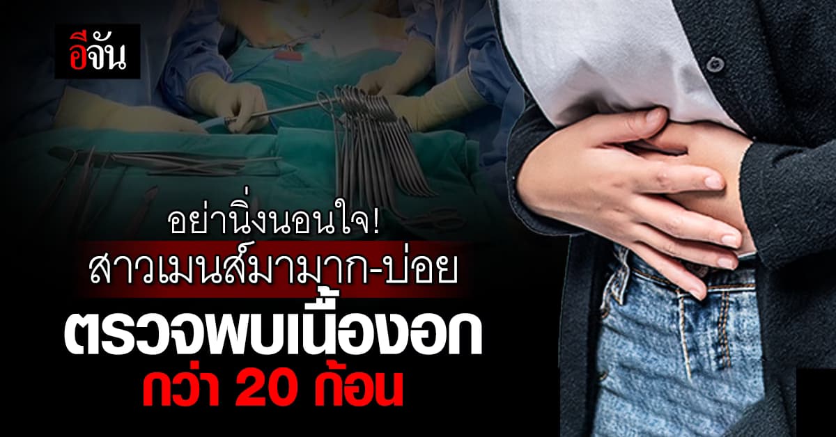 อุทาหรณ์ สาวเมนส์มามาก มาบ่อย ตรวจเจอเนื้องอก กว่า 20 ก้อน