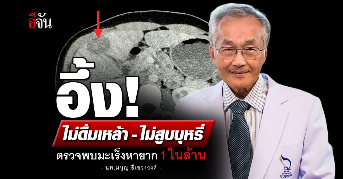 หมอมนูญ ยกเคสคนไข้ไม่ดื่มเหล้า-ไม่สูบบุหรี่ ตรวจพบมะเร็งหายาก 1 ในล้าน