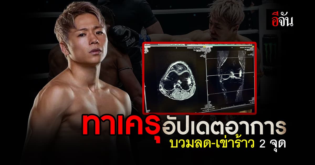 ทาเครุ เซกาวา คู่ชก ซุปเปอร์เล็ก อัปเดตอาการ พบกระดูกเข่าร้าว 2จุด