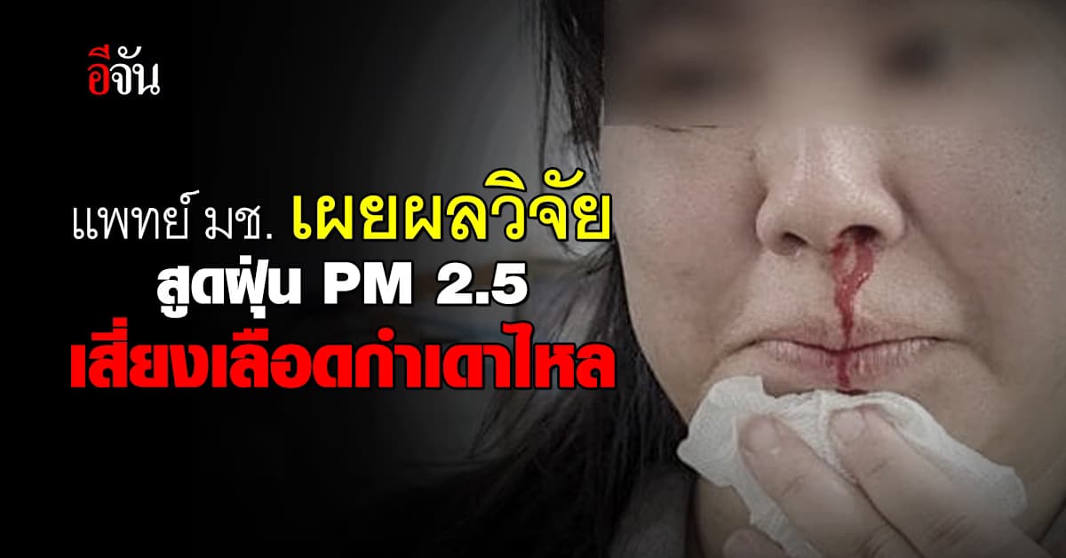 แพทย์ มช. เผยผลวิจัย สูดดมฝุ่น PM 2.5 มีผลทำให้เลือดกำเดาไหล