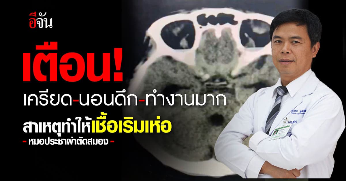 อันตราย! เครียด ทำให้เชื้อเริมเห่อ ภูมิตกเสี่ยงเชื้อขึ้นสมองอาจตายได้