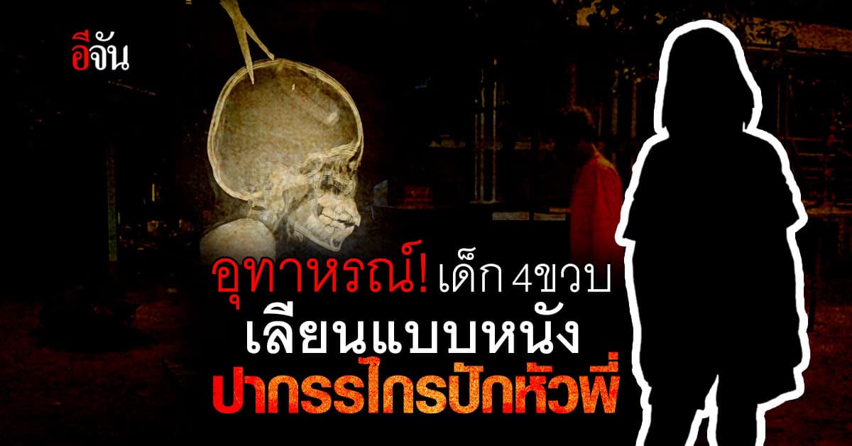 อุทาหรณ์! เด็ก 4 ขวบ เลียนแบบหนัง ปากรรไกรปักหัวพี่สาว ทะลุกะโหลก