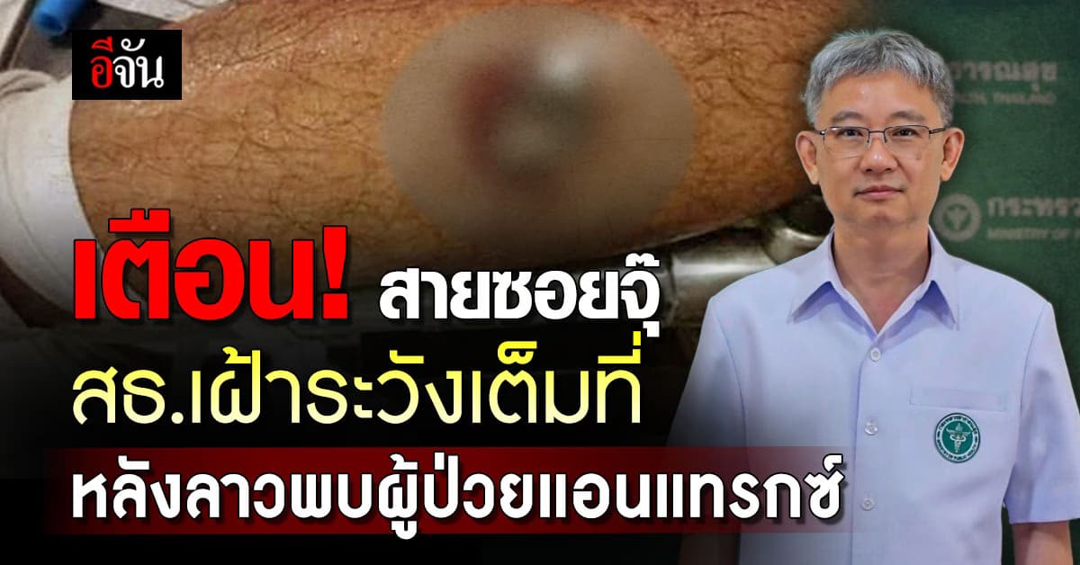 เตือนภัย! สายซอยจุ๊ สธ.เฝ้าระวังเต็มที่ หลังลาวพบผู้ป่วยแอนแทรกซ์ 54 ราย