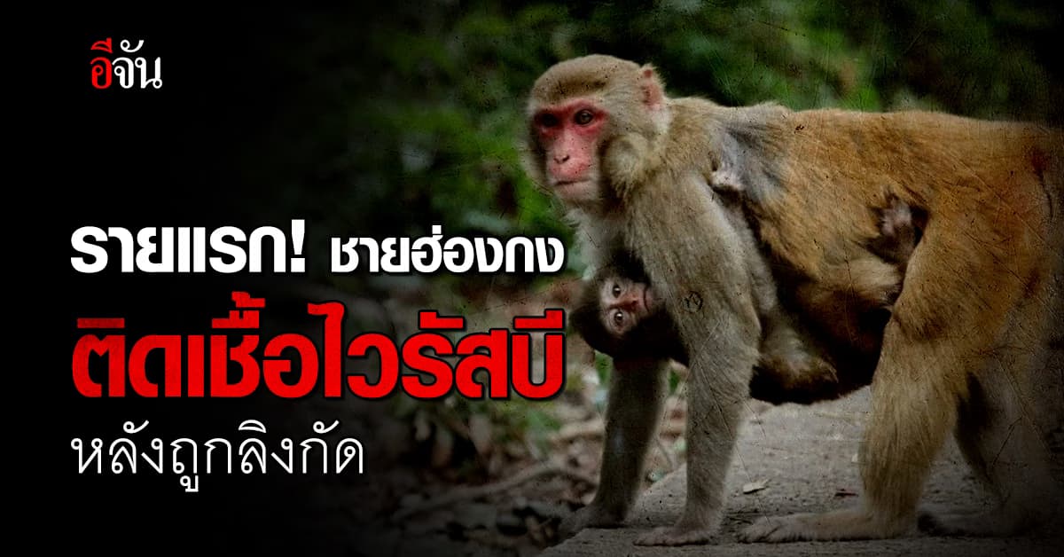 ฮ่องกง พบผู้ติดเชื้อไวรัสบี – Monkey B รายแรก หลังถูกลิงกัด   