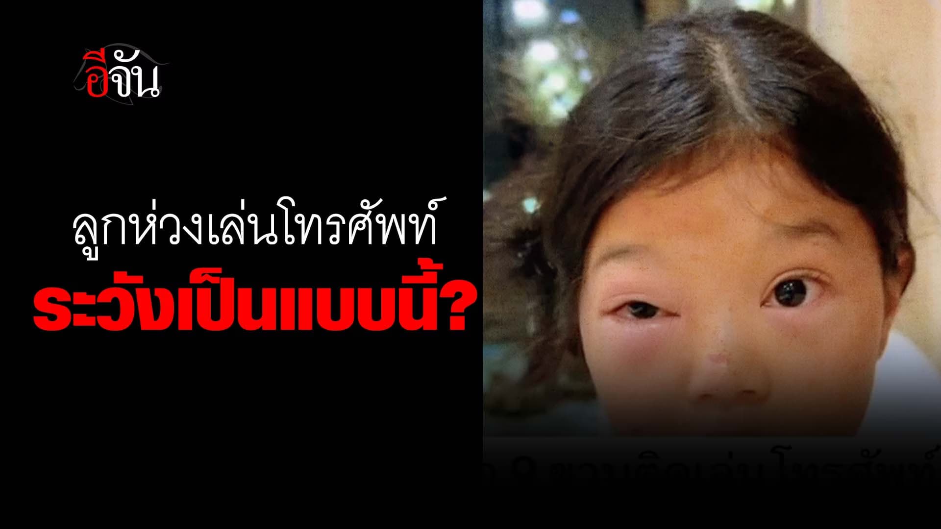 🎬 ลูกห่วงเล่นโทรศัพท์ ระวังเป็นแบบนี้?