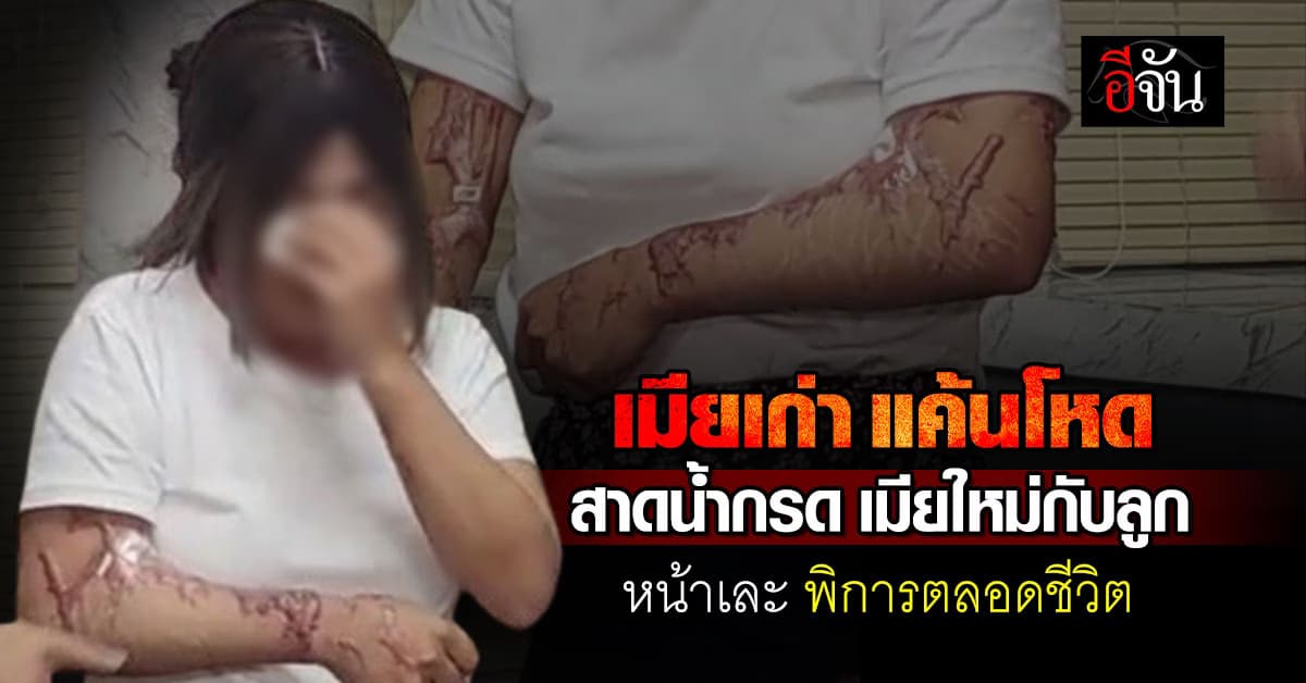 เมียเก่า แค้นโหด สาดน้ำกรด เมียใหม่ – ลูก 8 เดือน หน้าเละผิดรูป พิการ