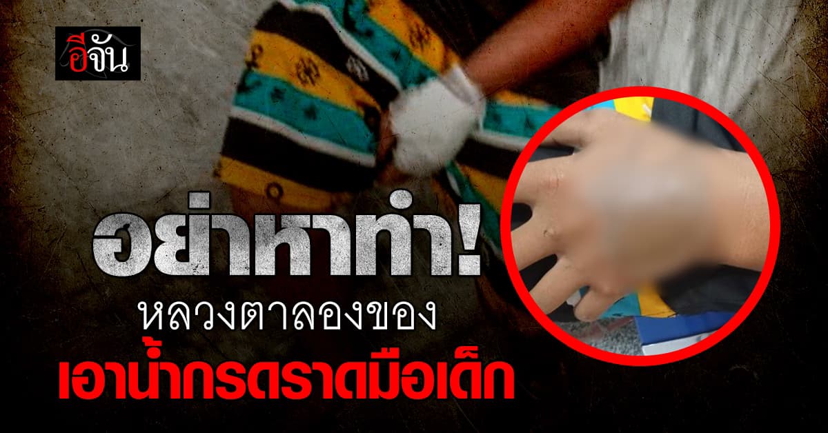 หลวงตา จ้างเด็ก ลองของขลัง ใช้น้ำกรดราดมือ สุดท้ายเด็กบาดเจ็บ พ่อแม่เอาเรื่อง