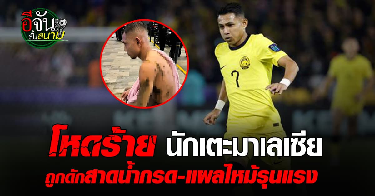 นักฟุตบอลมาเลเซีย ถูกคนร้ายดักสาดน้ำกรด ตร.รวบผู้ต้องสงสัย 2 ราย 