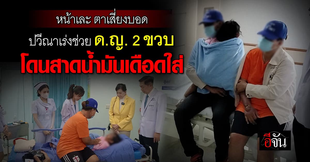 โหดร้าย! สาดน้ำมันเดือดใส่เด็ก 2 ขวบ หลังทวงเงินค่าเช่าห้องจาก แม่ไม่ได้