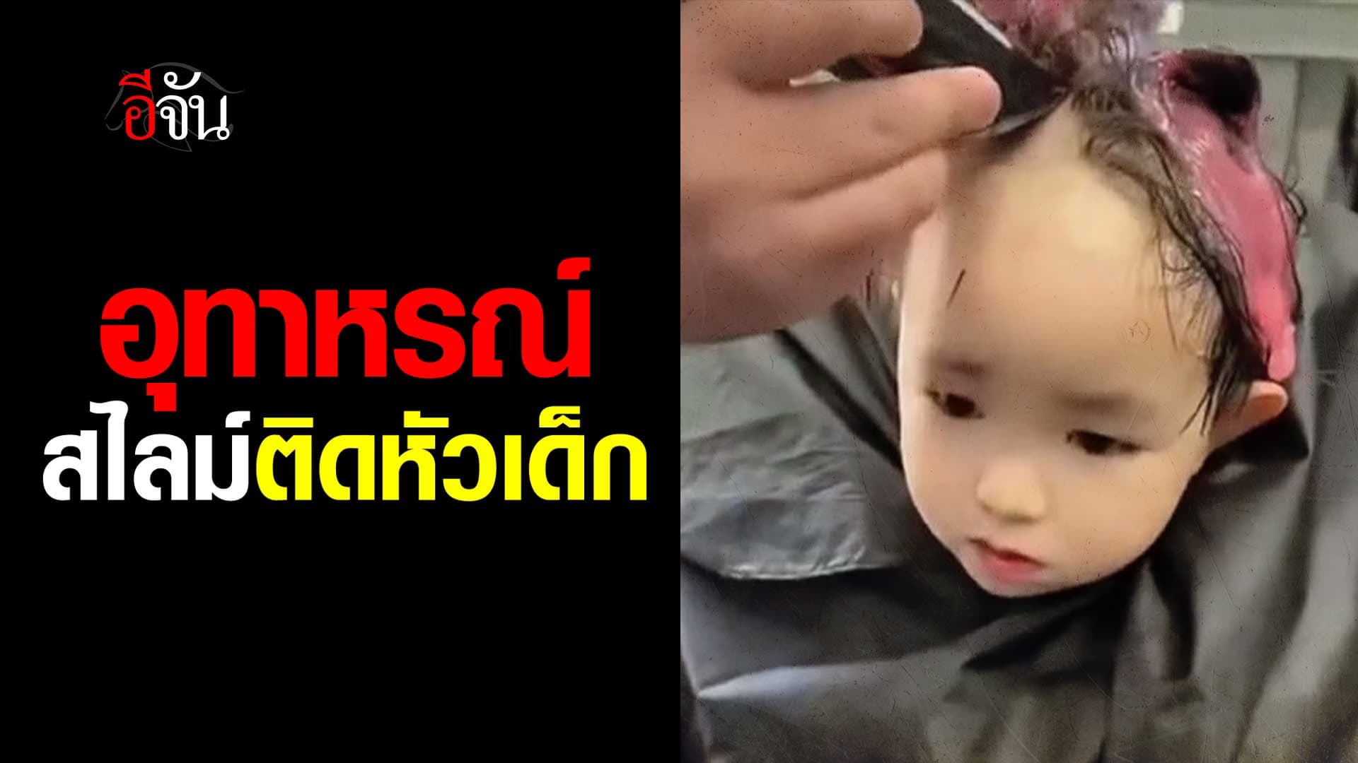 🎬 อุทาหรณ์ สไลม์ติดหัวเด็ก