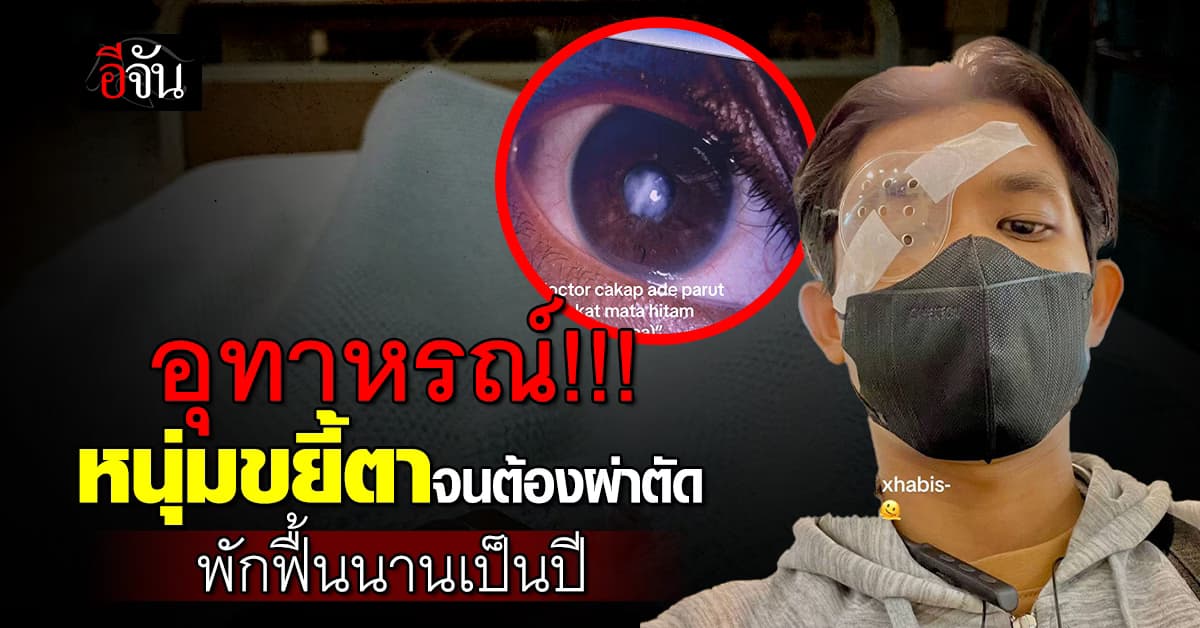 เลิกได้เลิก! หนุ่ม แชร์อุทาหรณ์ “ขยี้ตาจนต้องผ่าตัด” พักฟื้นนานเป็นปี