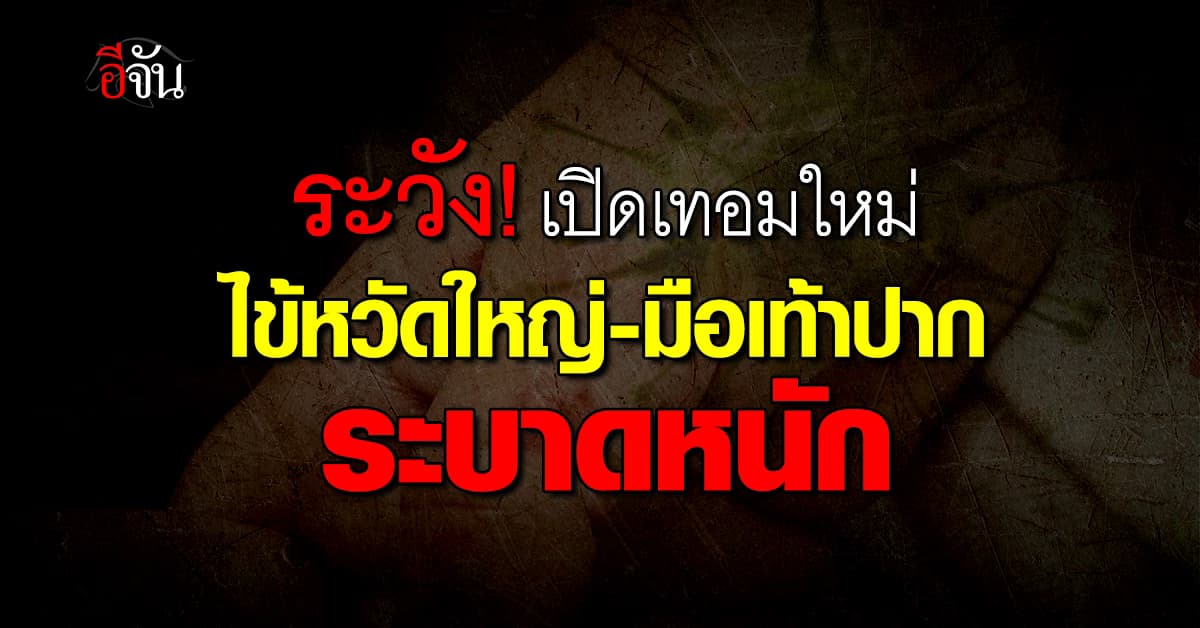 ระวัง! เปิดเทอมใหม่ ไข้หวัดใหญ่-มือเท้าปาก ระบาดหนัก นักเรียนติดเพียบ