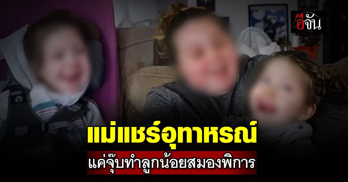 แม่แชร์อุทาหรณ์ ลูกน้อยสมองพิการ เพราะญาติๆ จูบหอม