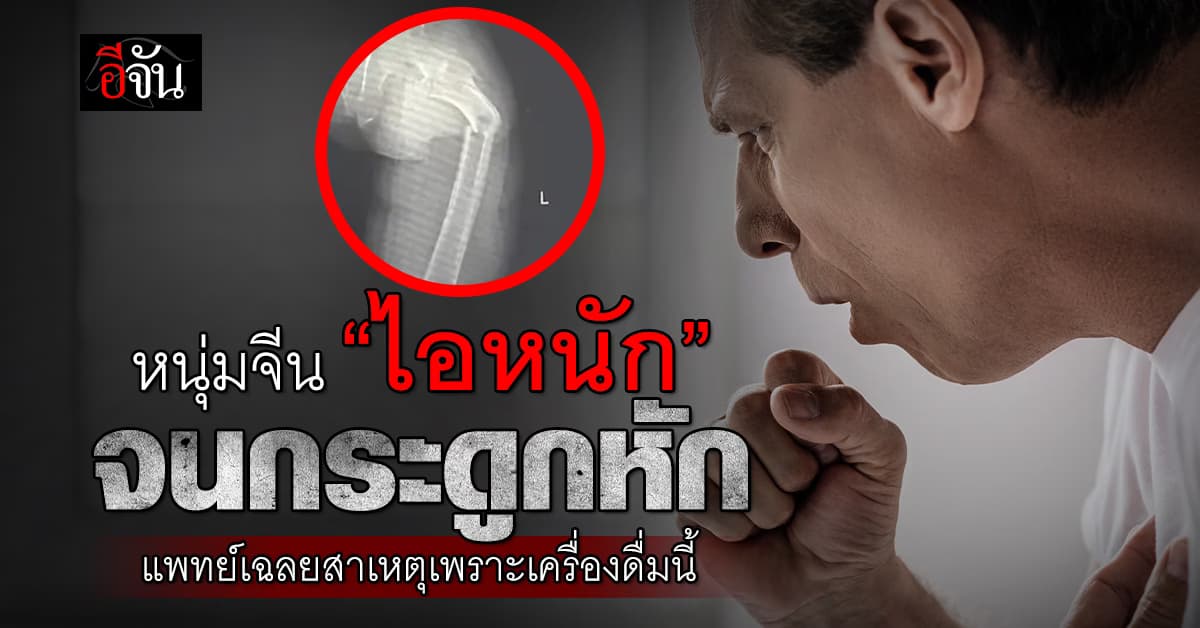อึ้ง หนุ่มจีนวัย 35 ปี ไอหนักจนกระดูกขาหัก หมอเผยเพราะกินเครื่องดื่มนี้