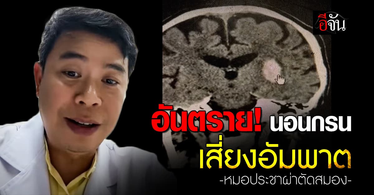อันตราย! นอนกรน เสี่ยงอัมพาต