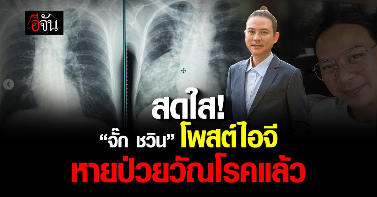 สดใส! “จั๊ก ชวิน” โพสต์ไอจีหายป่วยวัณโรคแล้ว