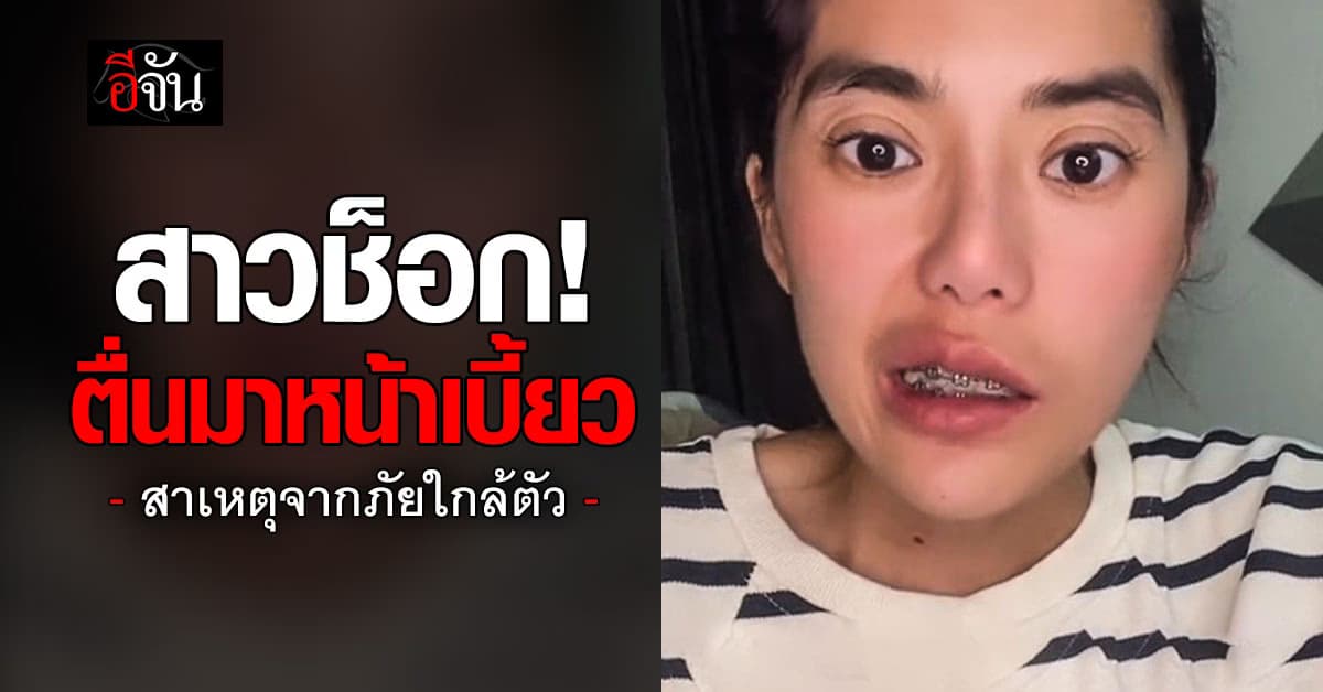 สาวช็อก! ตื่นเช้ามาหน้าเบี้ยว กะพริบตาได้ข้างเดียว สาเหตุจากภัยใกล้ตัว