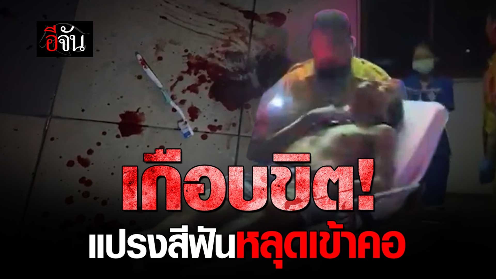 🎬 อุทาหรณ์ แปรงสีฟันหลุดเข้าคอ