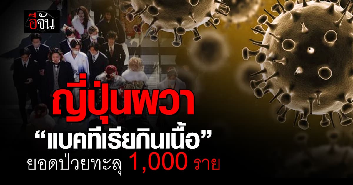 ญี่ปุ่นผวา“แบคทีเรียกินเนื้อ” ระบาดหนัก ยอดป่วยทะลุ 1,000 ราย